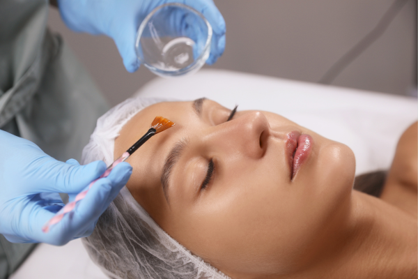 SẢN PHẨM PEEL DA DÀNH CHO SPA/CLINIC TỐT NHẤT HIỆN NAY